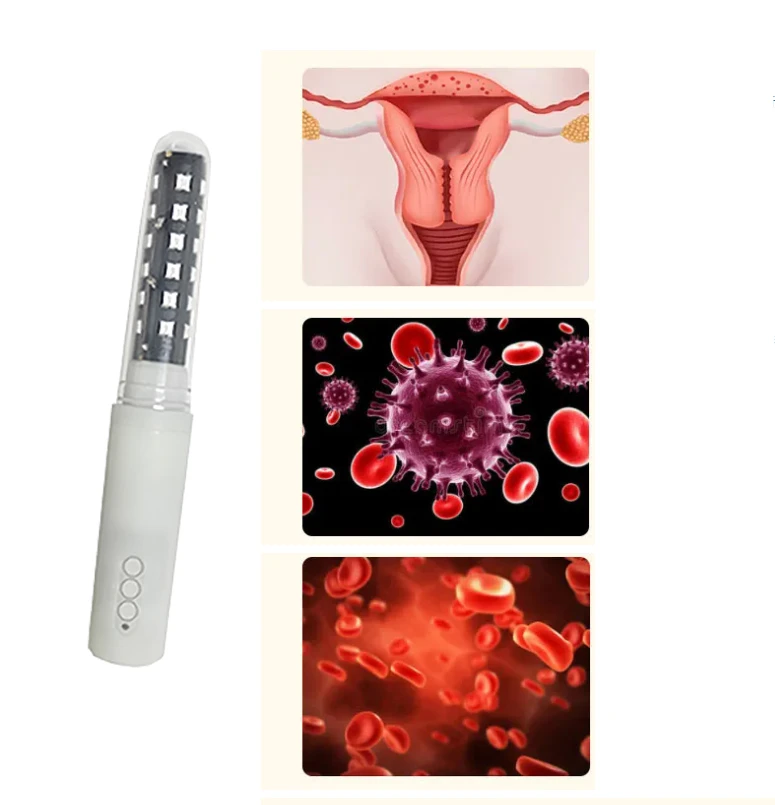 female laser treatment for pelvic floor female laser treatment for pelvic floor