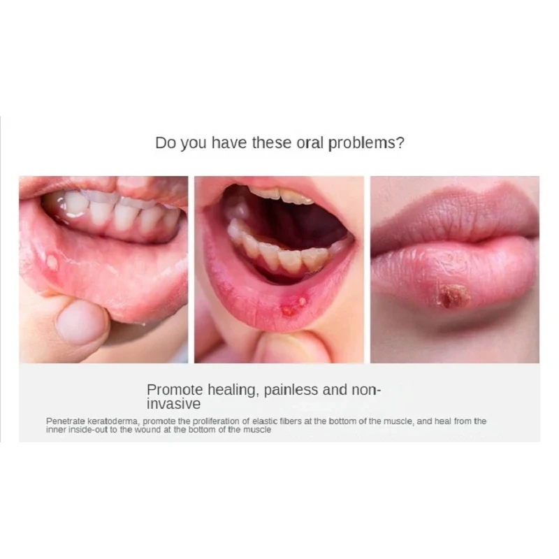 diode laser periodontal therapy