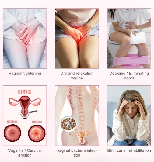 vigina tightening laser treatment1 vigina tightening laser treatment1