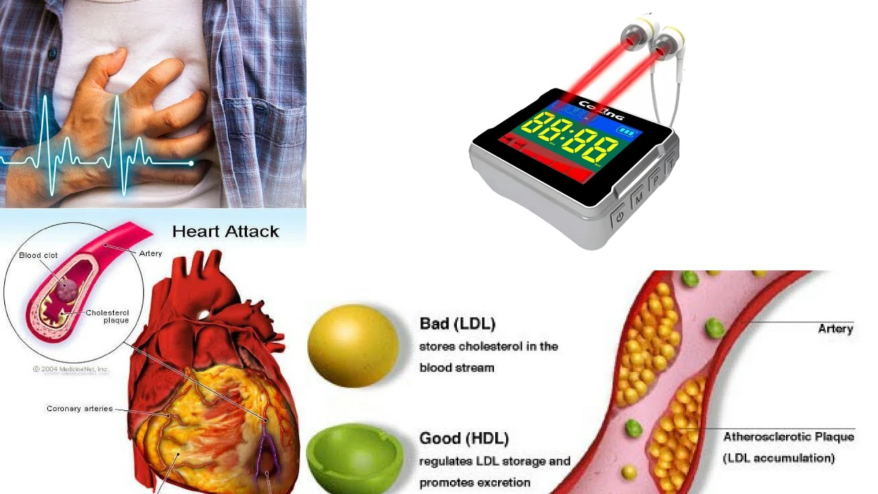 hypertension laser watch