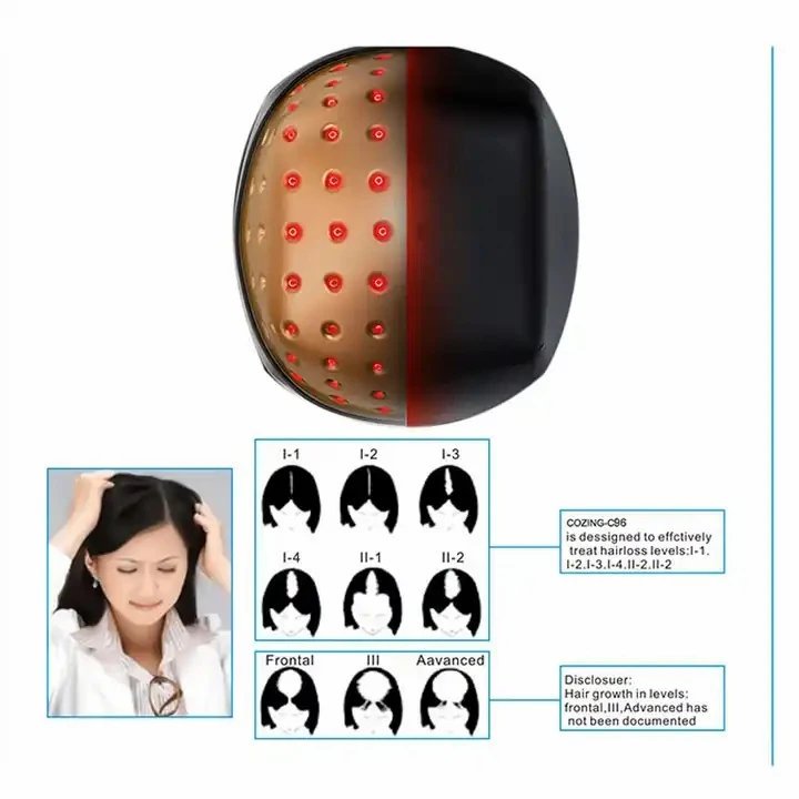 red light helmet for hair loss1 red light helmet for hair loss1