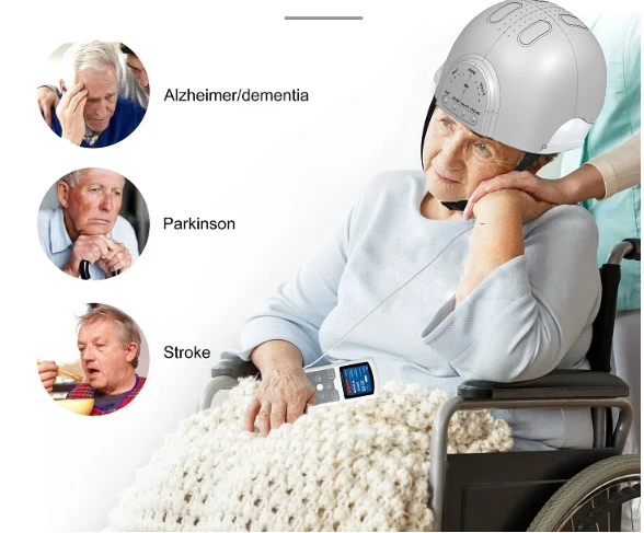 red light therapy for alzheimers red light therapy for alzheimers