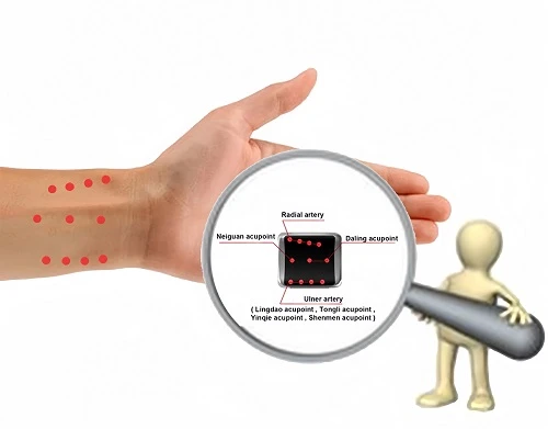 hypertension laser therapy watch -