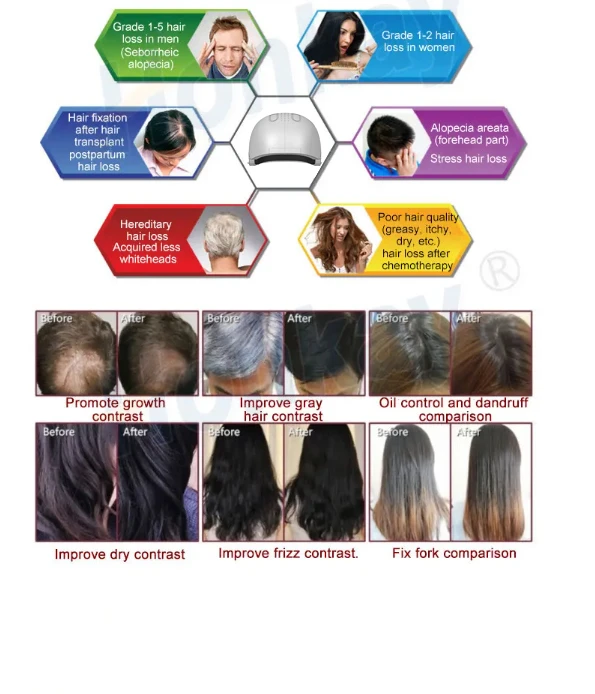 light cap for hair growth light cap for hair growth