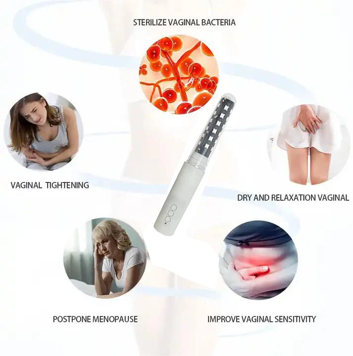 Pelvic Floor Laser Treatment